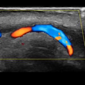 Aesth labial artery L20 HD3 Tablet.png