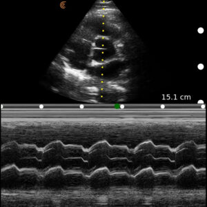 Cardiac MedEd CC AV Mmode PA HD Tablet.jpg