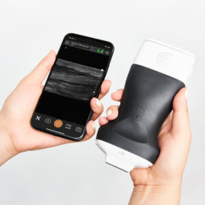 Clarius L20 scaled 1.jpg